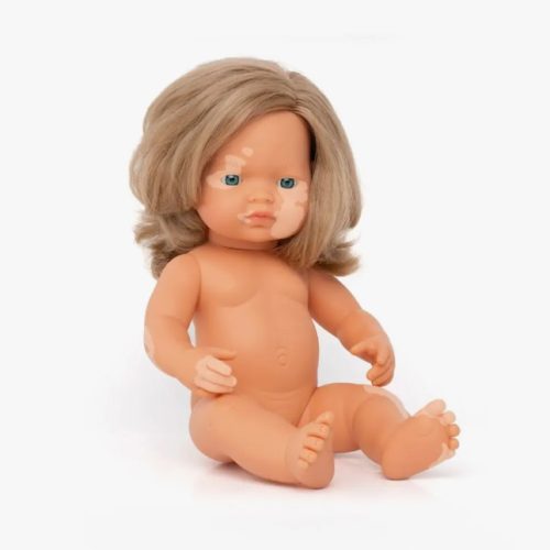 ML-31228.jpg Bebé Europeu Vitiligo - Menina
